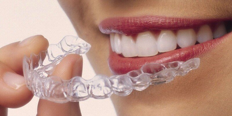 Invisalign