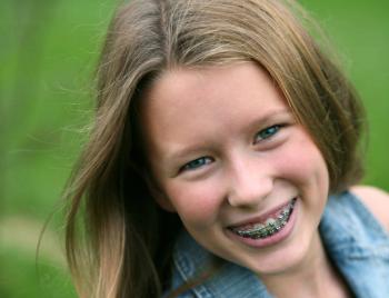 Kind orthodontie 2
